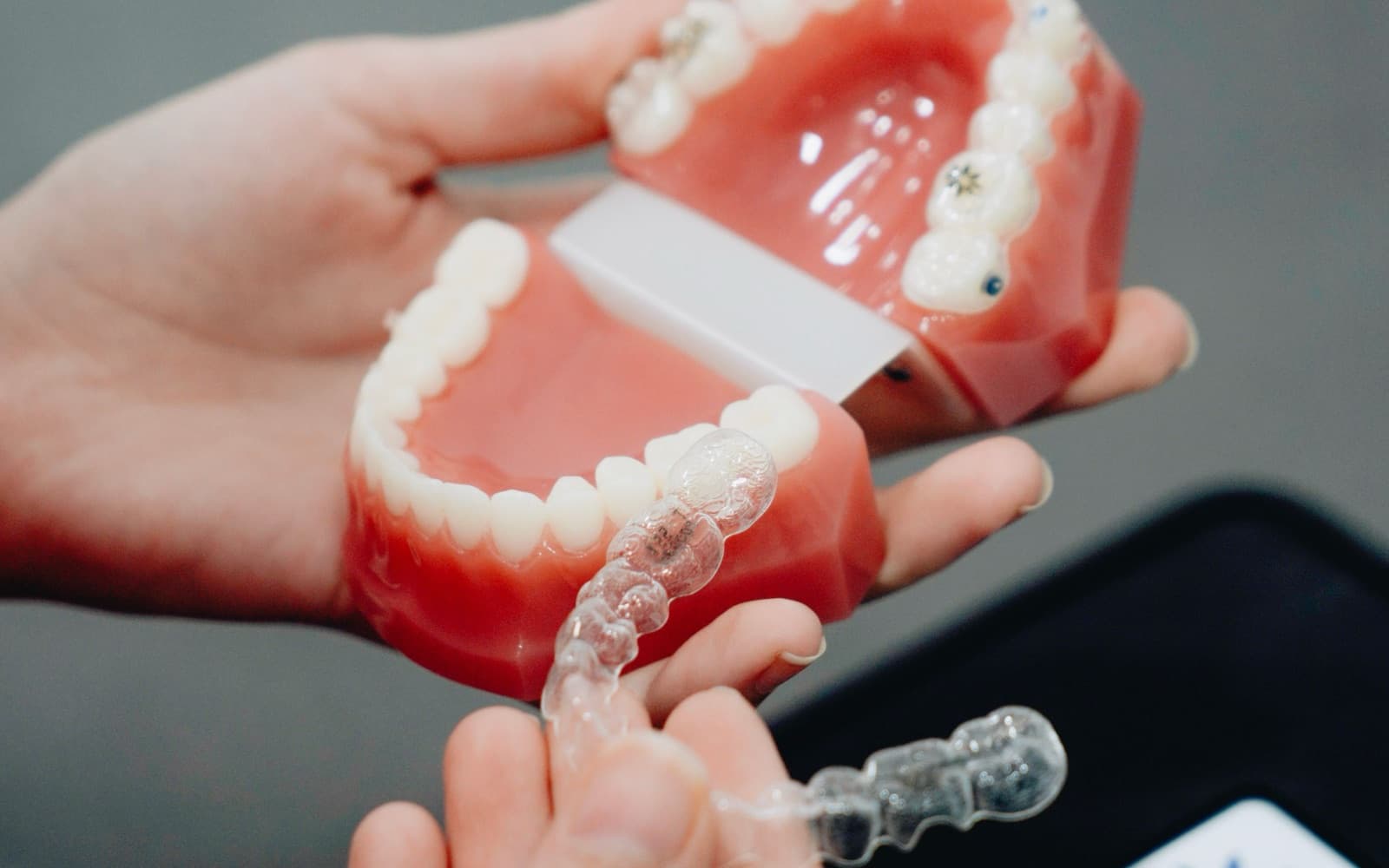 Invisalign vs Traditional Braces: Which Is Right for You?
