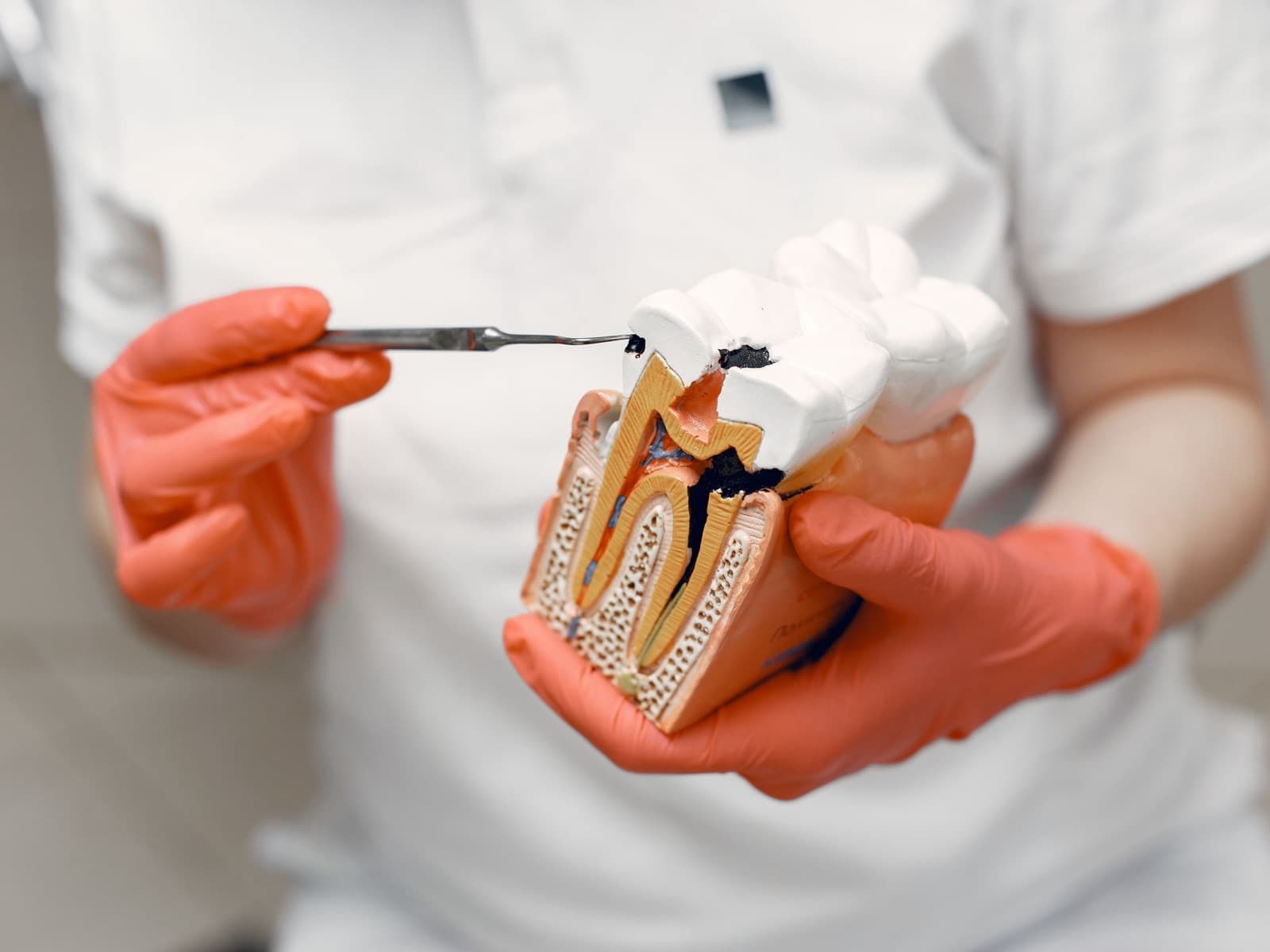 Root Canal Treatment